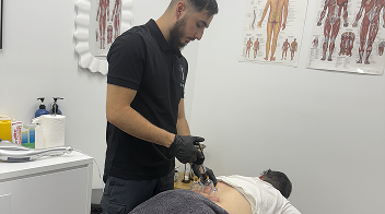 cupping-therapy-experience